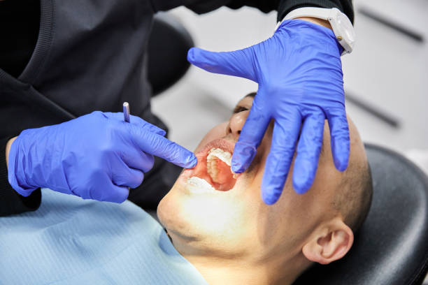Best Emergency Root Canal Treatment in Steelevle, IL